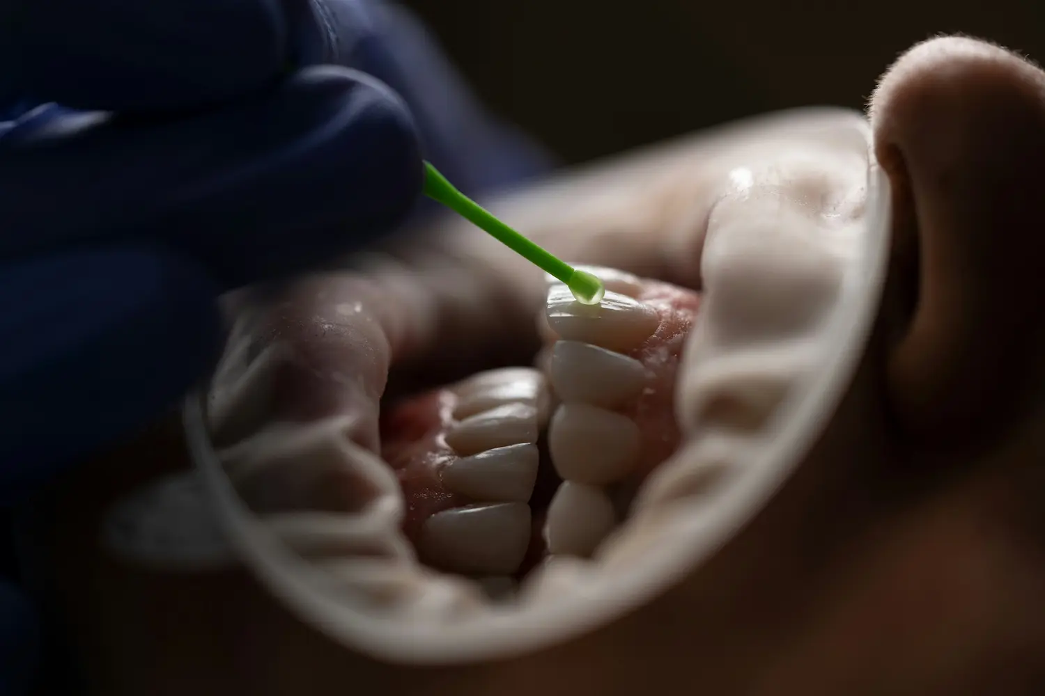 Dental Cleaning