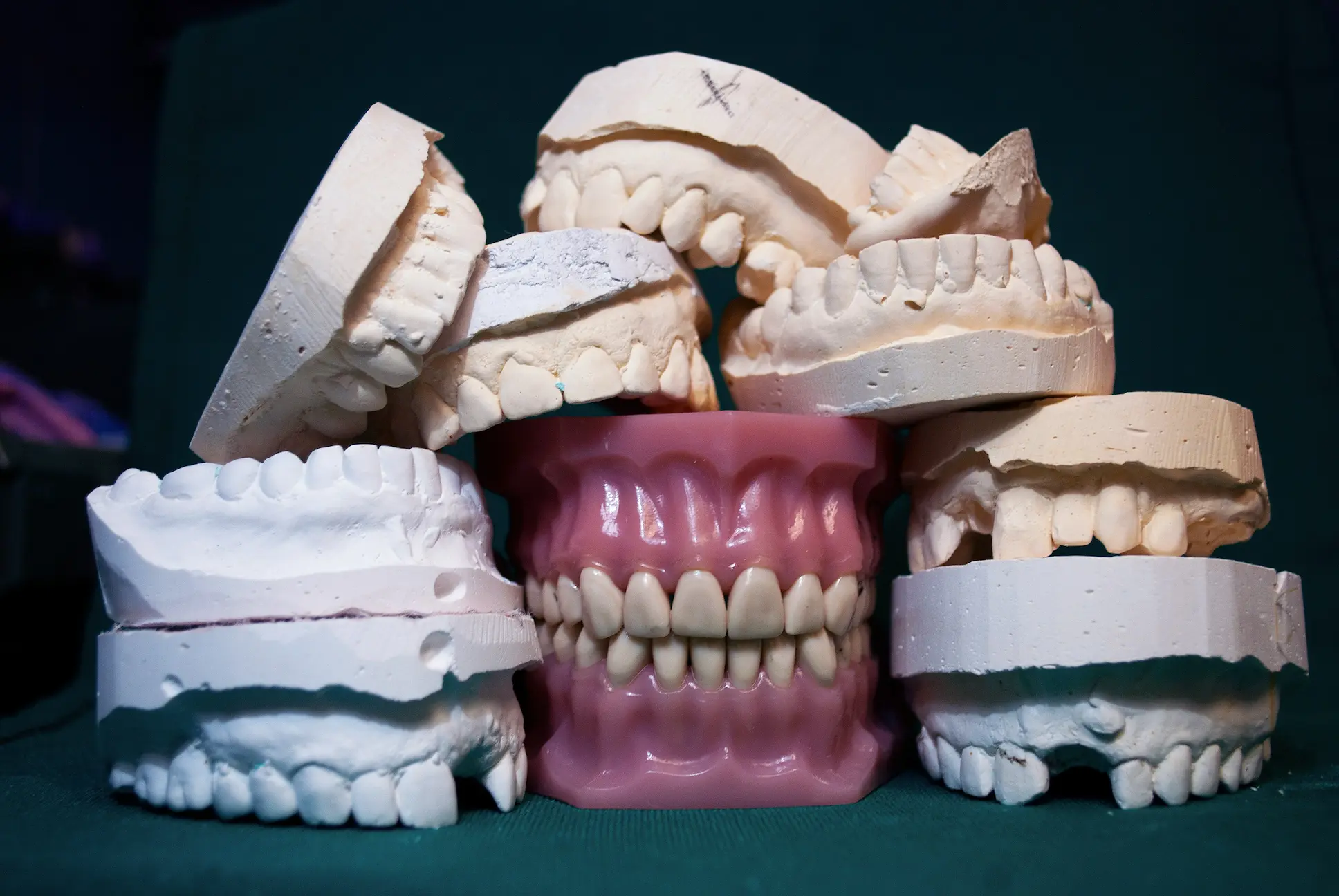 Full Dentures