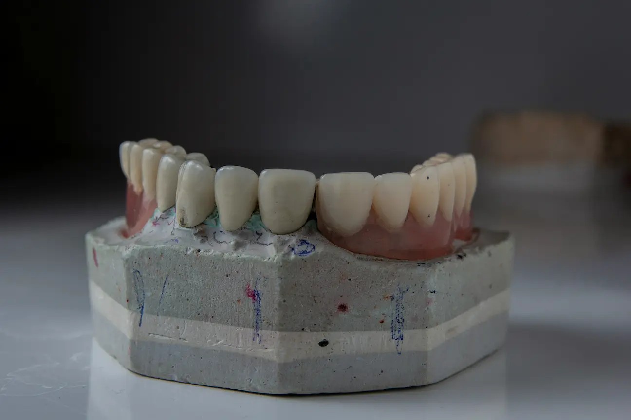 Root Canal Treatment