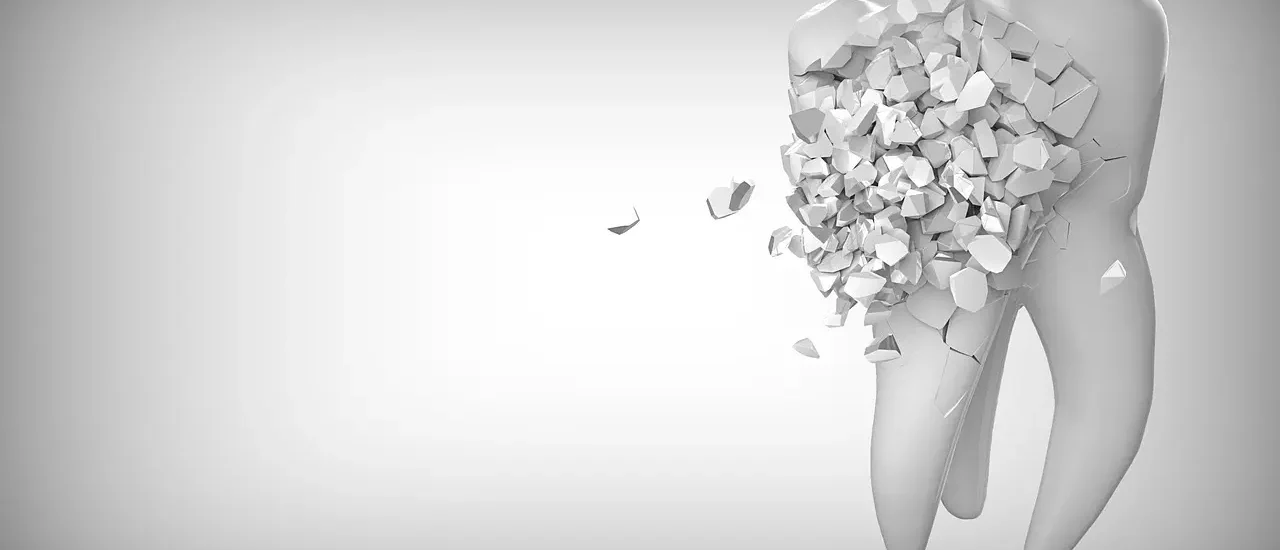 Affordable Oral Surgery in Latin America A Cost-Effective Solution for Quality Dental Care